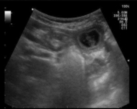 Echografie